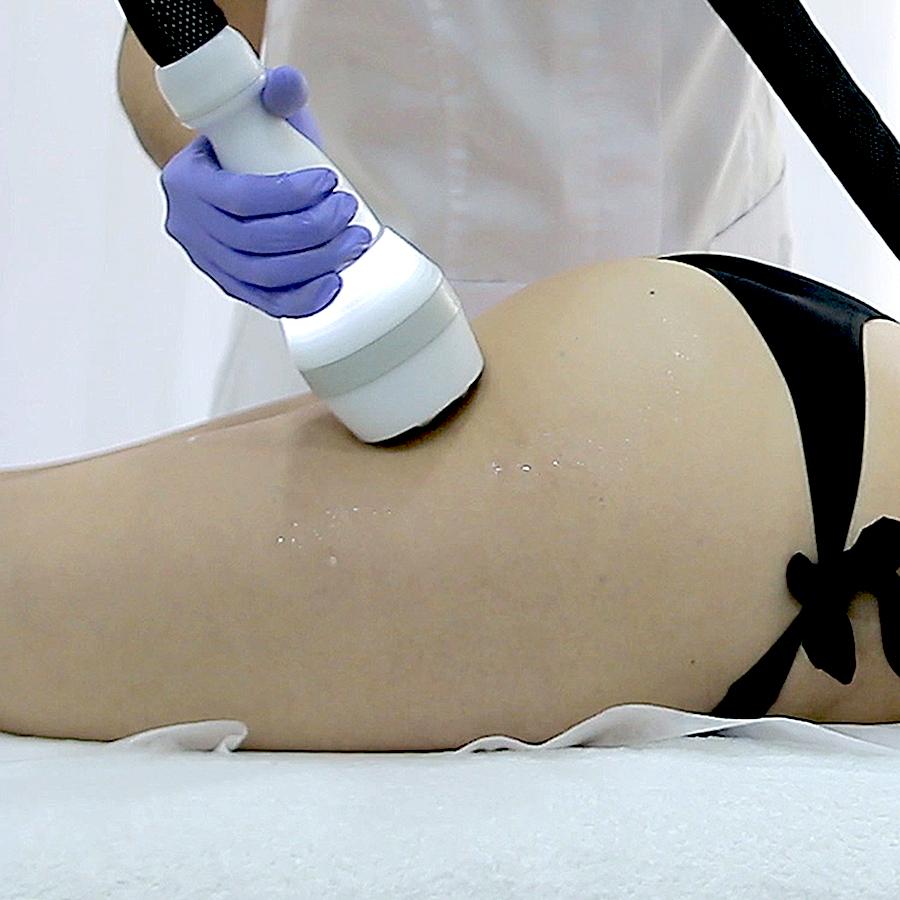 Criofrequencia Facial