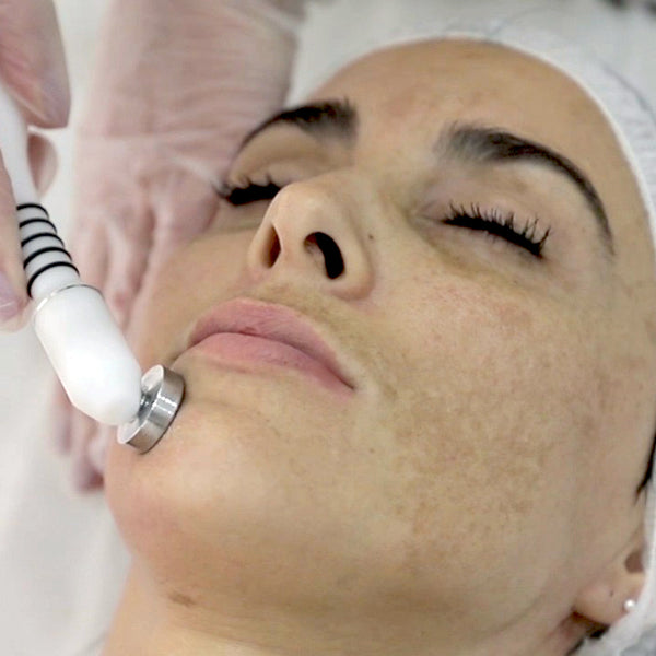 Endermoterapia – Microdermoabrasão